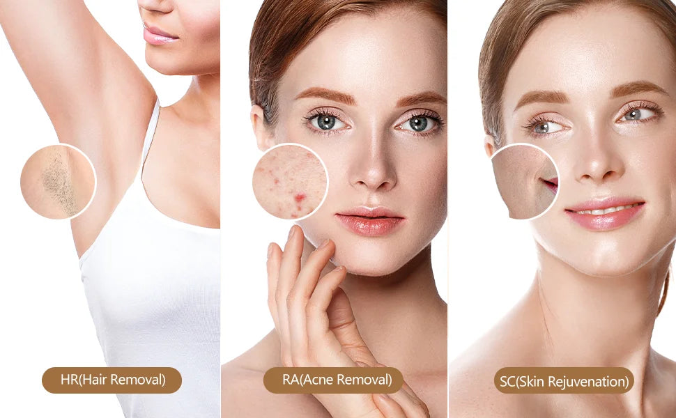 Laser Hair Removal Painless Permanent Electric Depilador