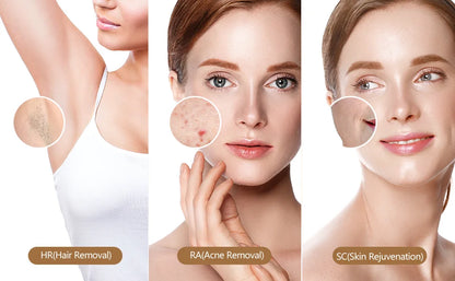 Laser Hair Removal Painless Permanent Electric Depilador